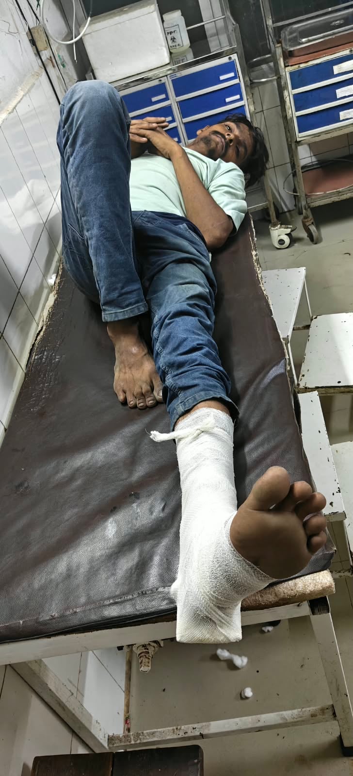 Auraiya News: कस्टडी से भागे आरोपी का टूटा पैर, भेजा जेल