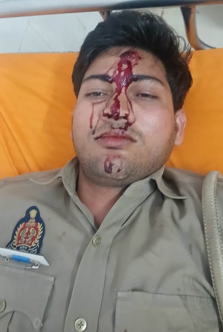 Sitapur News: विवाद सुलझाने पहुंचे सिपाही पर युवक ने किया जानलेवा हमला