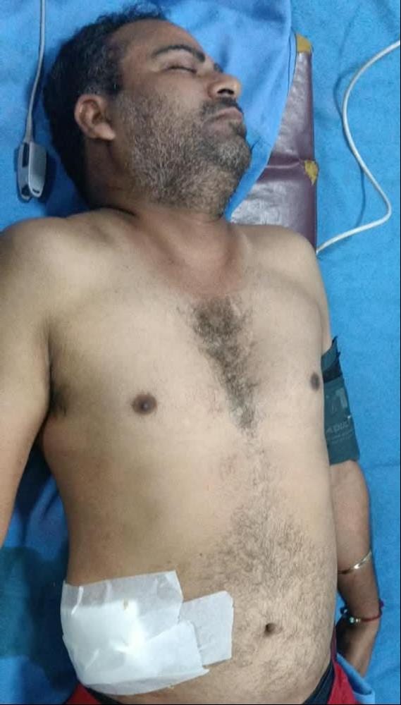 बदलापुर के बरौली निवासी गोली से घायल संदीप सिंह उर्फ पोद्दार का वाराणसी के ट्रामा सेंटर में चल 