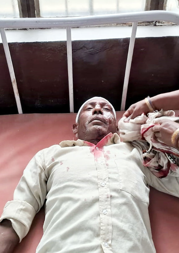Budaun News: हाईवे पर कैंटर की टक्कर से ई-रिक्शा के उड़े परखचे, दो गंभीर