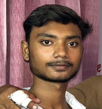 Hamirpur News: जहरीले कीड़े के काटने से छात्र की मौत