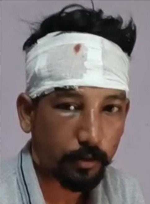 फोटो-घटना में घायल पीड़ित रोहित