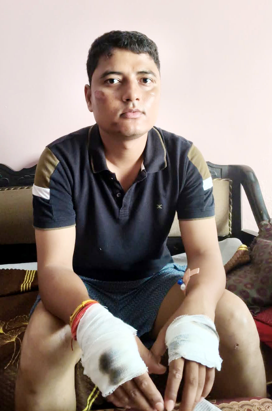 Budaun News: हाईवे पर स्कूटी से टकराई बाइक, एसआई घायल