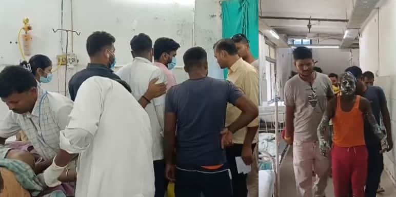 Muzaffarpur Bihar news :worker severely burned in sudden explosion while working at factory admitted