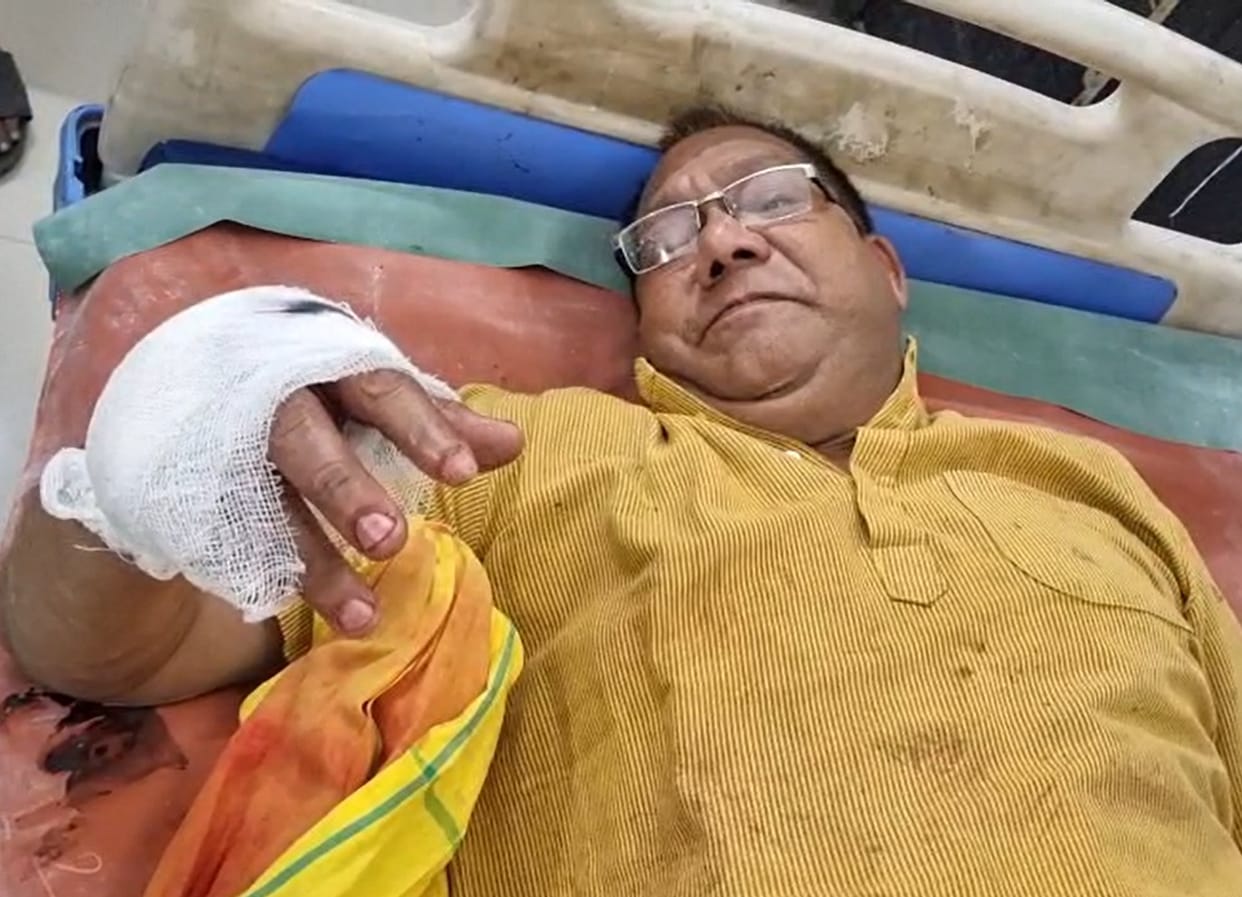 Businessman shot following a dispute over car parking; FIR registered against father and son