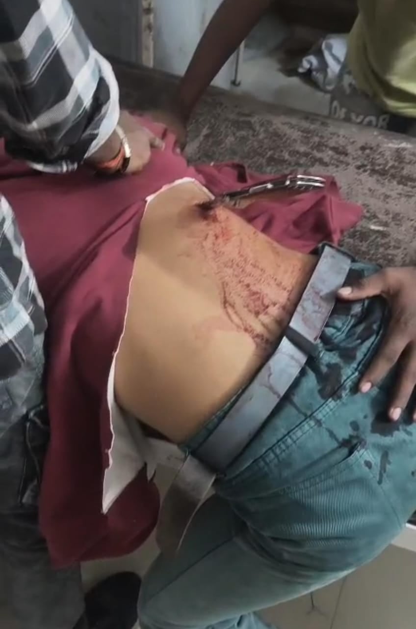 Siddharthnagar News: नाैडिहवा पुल पर घेरकर युवक की पीठ में चाकू घोंपकर भागा