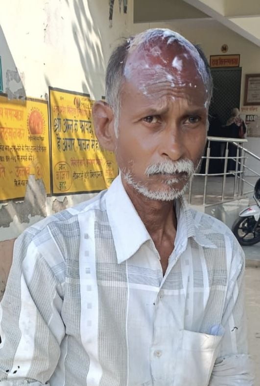 Unnao News: झोपड़ी में लगी आग से गृहस्थी जली, गृहस्वामी झुलसा