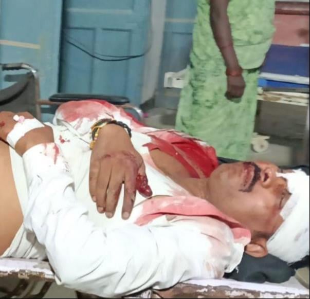 Raebareli News: अज्ञात वाहन की टक्कर से साले की मौत, जीजा गंभीर