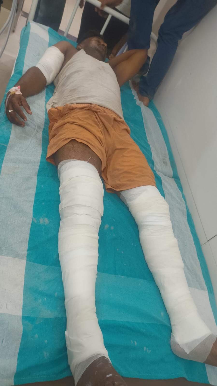 Sant Kabir Nagar News: बेकरी की दुकान में लगी आग बुझाने में मालिक झुलसा
