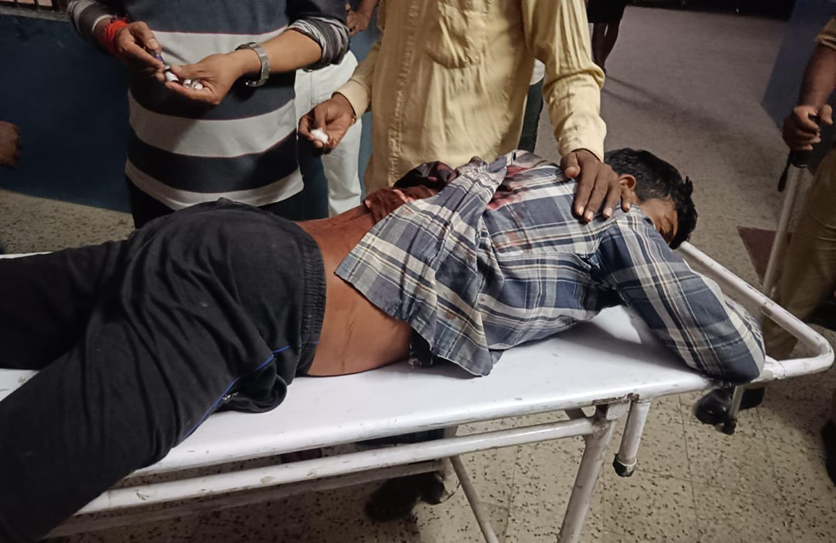 Jaunpur News: दुकान पर बैठे युवक पर सिर और पीठ पर चाकू से हमला