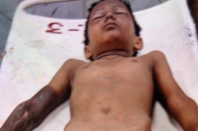 Lucknow News: लापरवाही के करंट से दो मासूम झुलसे, एक गंभीर