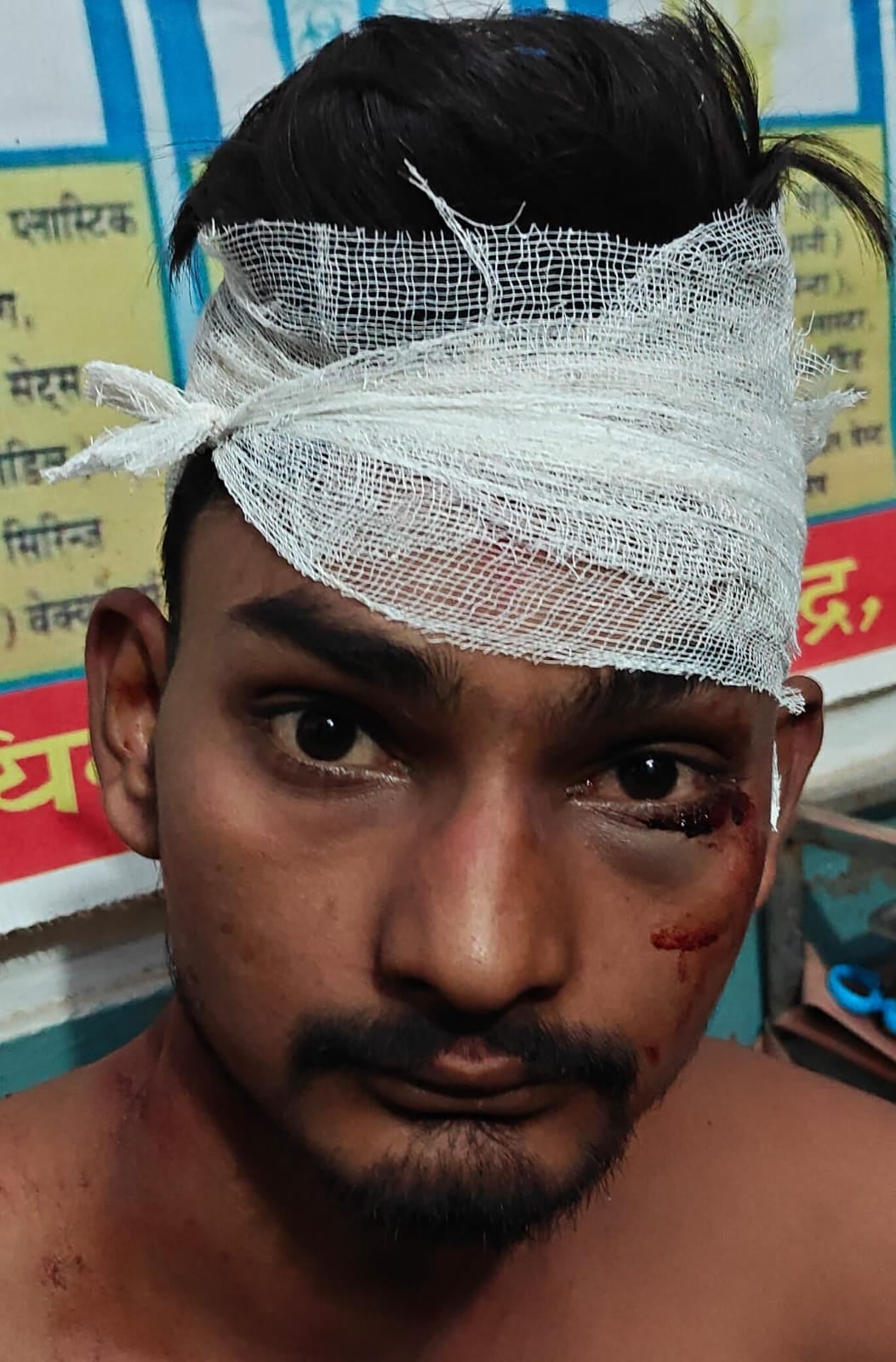 Jalaun News: डीजे पर डांस कर रहे युवकों पर लाठी-डंडों से हमला, दो के सिर फूटे