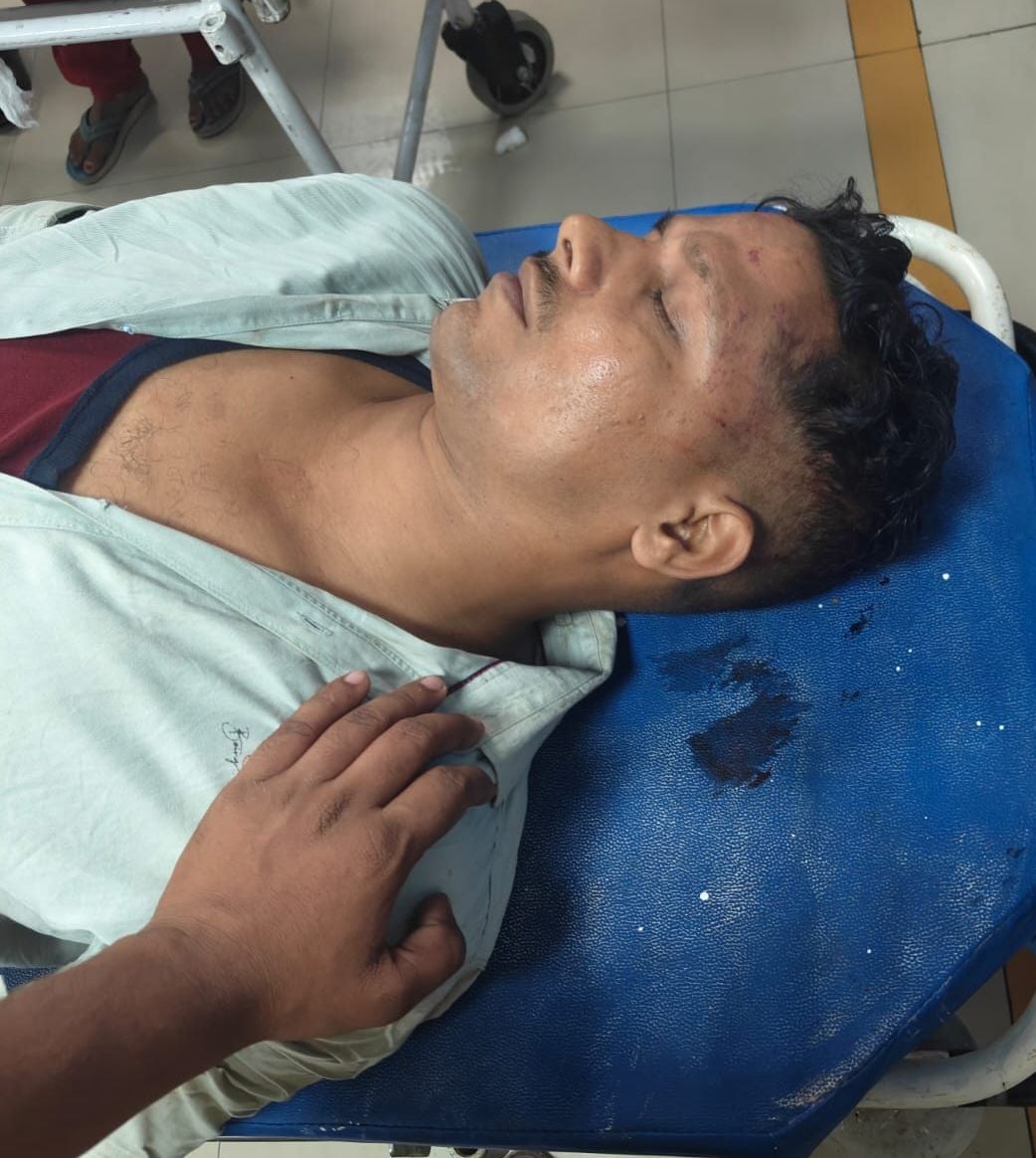 Lucknow News: पुलिस से शिकायत पर सिपाही को पीटा, बाइक सवार से टकराई थी पीड़ित की स्कूटी, एक गिरफ्तार