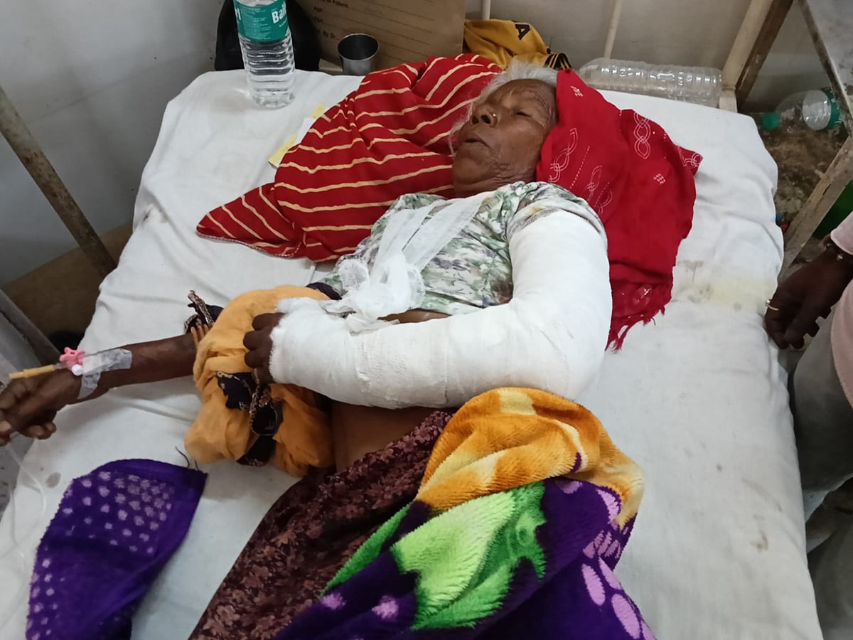 राजस्थान: बूंदी में आवारा कुत्तों का हमला, वृद्ध महिला के हाथ की हड्डी टूटी; शरीर पर कई जगह गहरे घाव