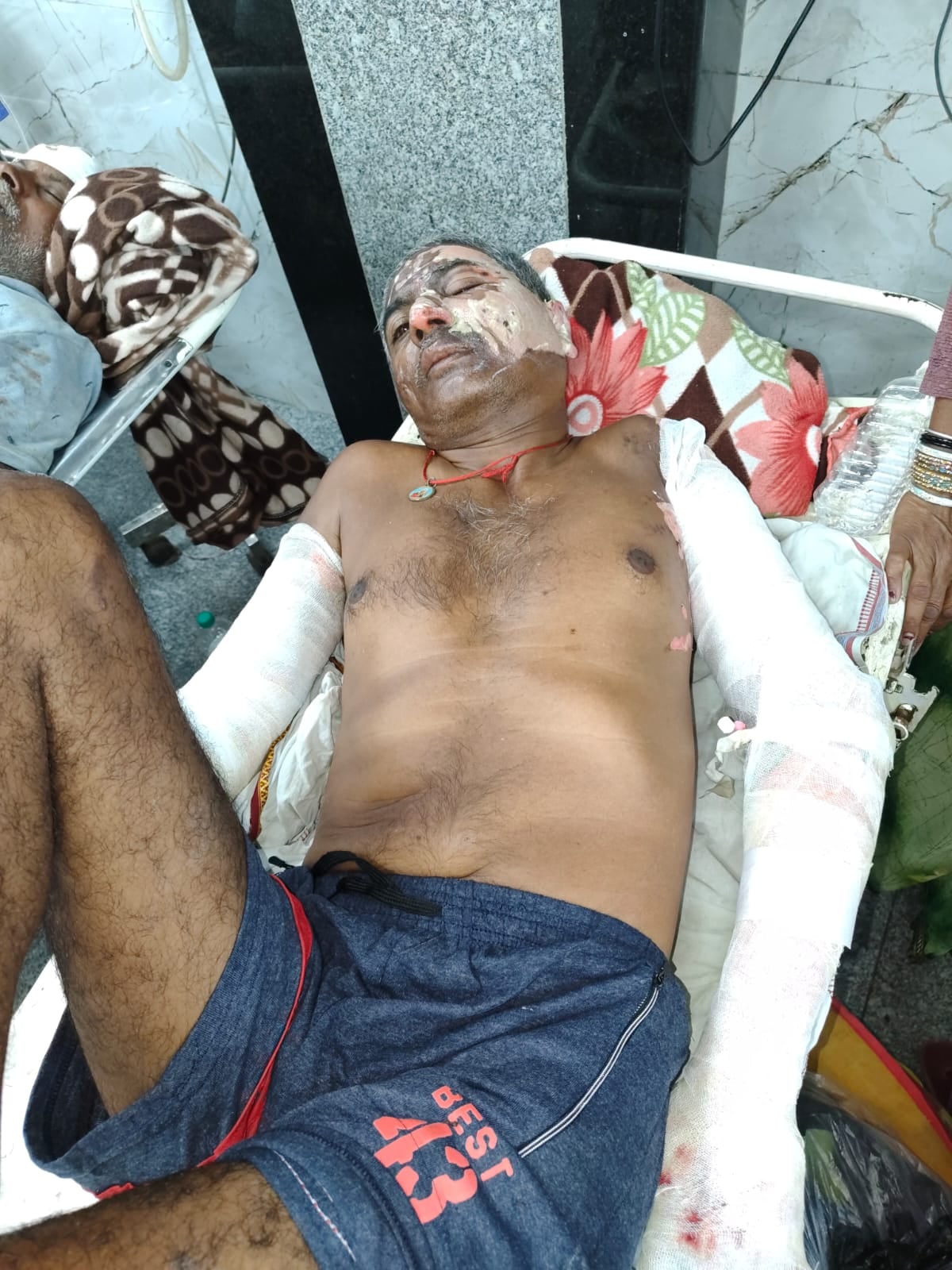 Hamirpur News: क्रेन ऑपरेटर की हालत नाजुक, कानपुर से लखनऊ रेफर