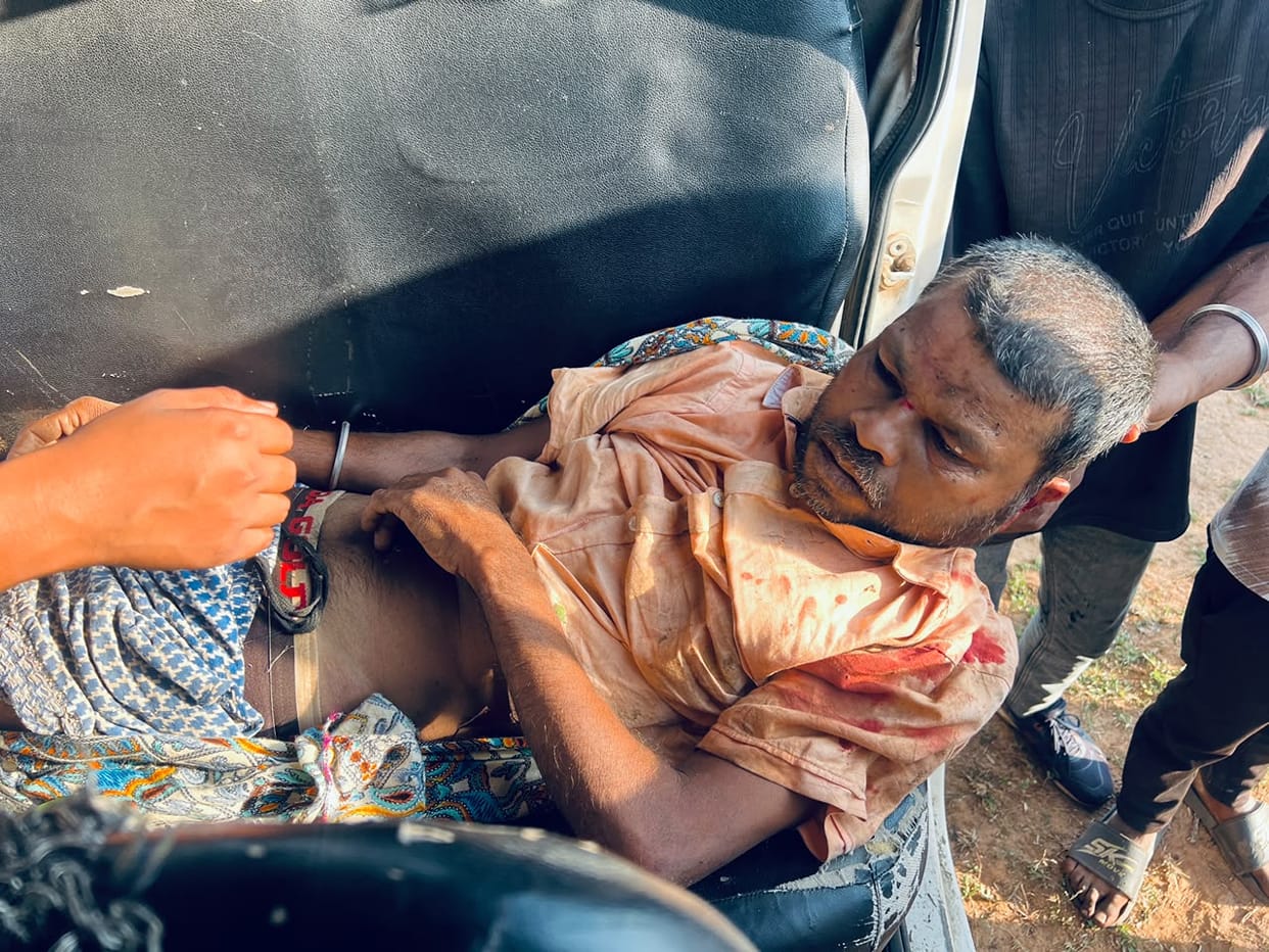 Amid the presence of wild elephants, a villager was critically injured in an elephant attack. The injured vill
