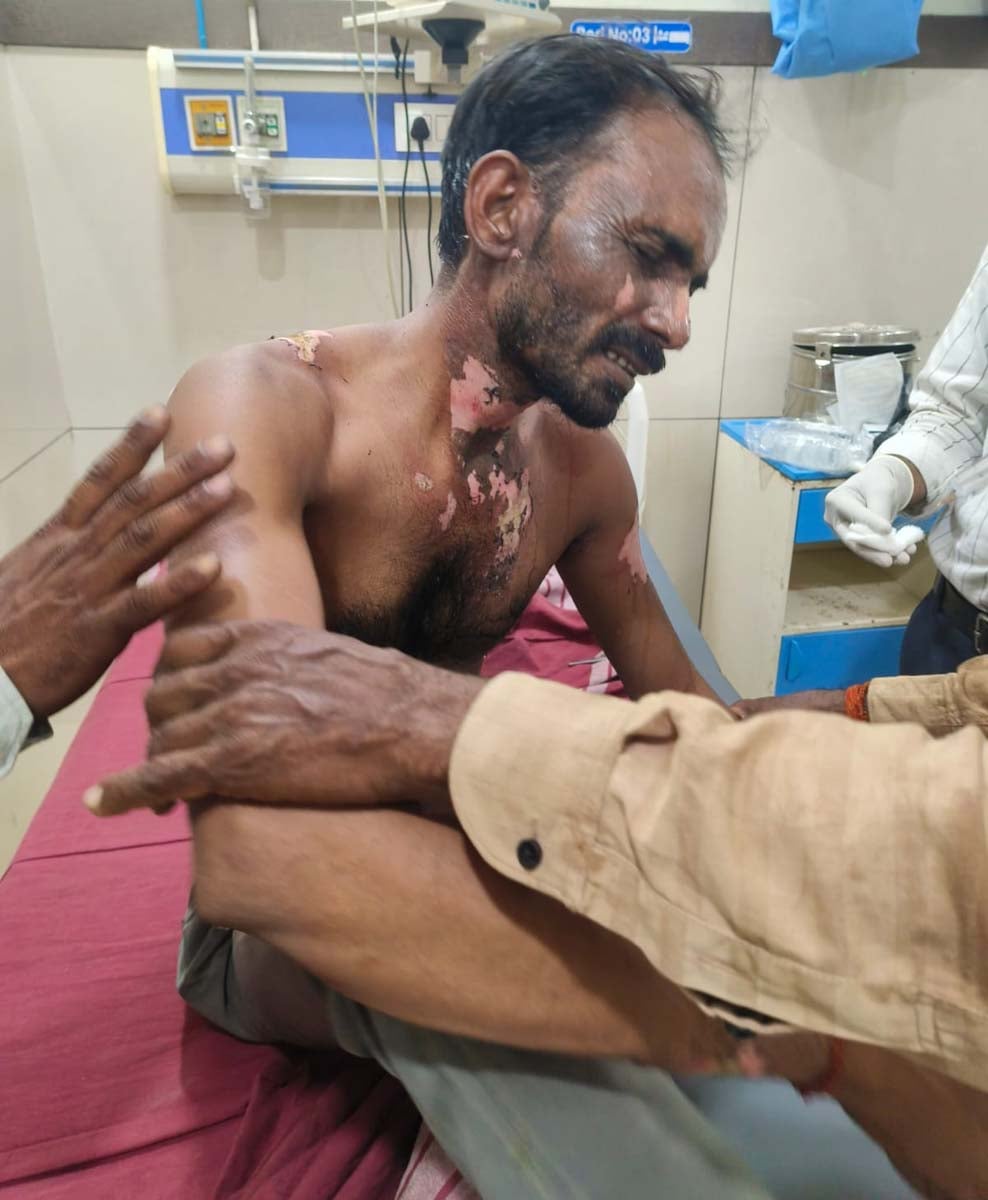 Shahjahanpur News: करंट लगने से संविदाकर्मी की हालत गंभीर