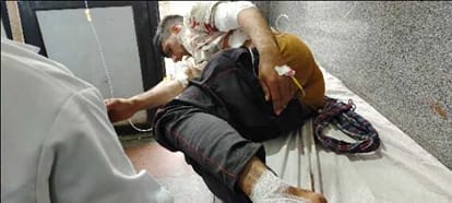 One Civilian Injured In Pakistani Shelling