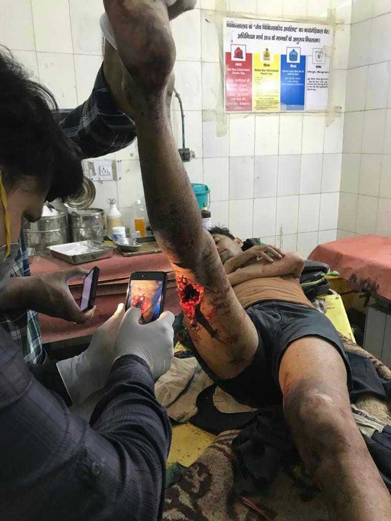 Wild boar attacked and injured fire watcher