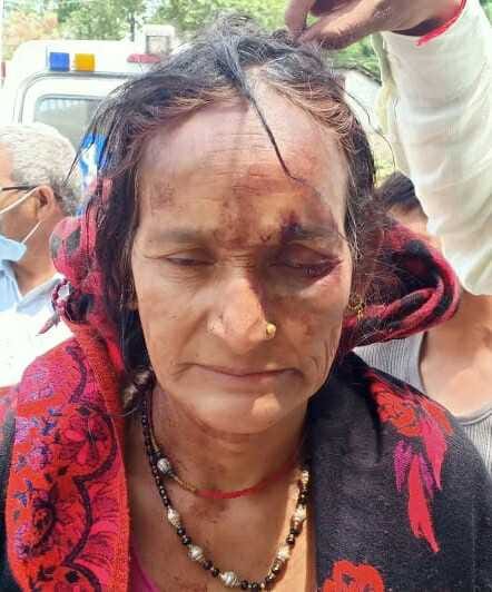 Khatigaon woman injured in leopard attack.