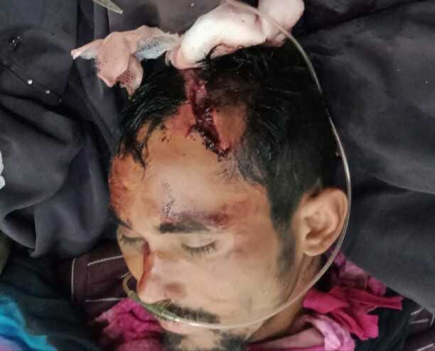 Man injured by falling into rock grip from hill.