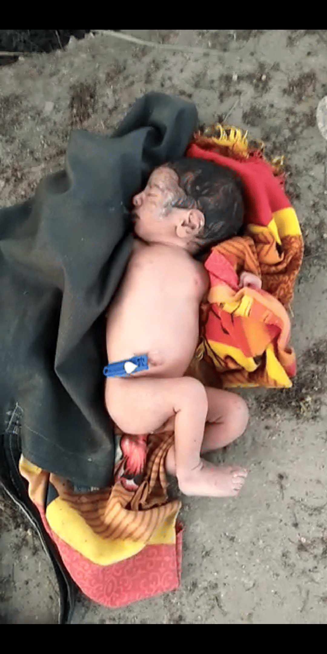 समाज पर कलंक, बेटी के जन्म पर कपड़े में लपेटकर औद्योगिक क्षेत्र में छोड़ा नवजात बच्चा