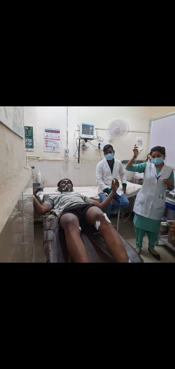 बॉयलर फटने से दो श्रमिक झुलसे