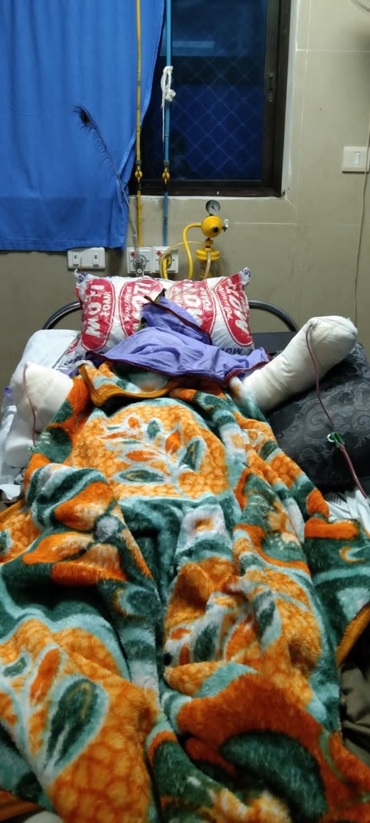 जान बचाने के लिए विद्युत संविदाकर्मी के काटने पड़े हाथ