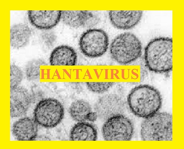 Hantavirus: Don't Panic, Check Symptoms and Preventions