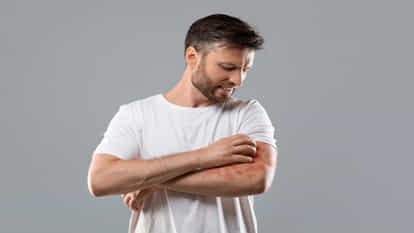 Skin Infections: त्वचा में संक्रमण या अक्सर रहती हो खुजली की समस्या, इन