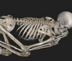 even mummies had heart disease