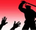 police beats students