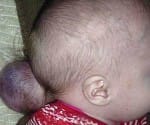 baby girl born with rare condition
