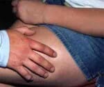 Bar bouncer attacks on a young man  with beer bottle, injured
