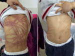 boy got beaten by his foster mother in chaina