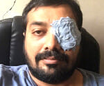 Anurag Kashyap injured