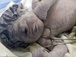 one eyed baby born in Egypt, difficult to survive