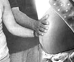 every women will not be eligible for surrogate mother
