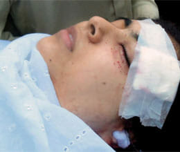 Malala Yousafzai Pakistan girl standing with help