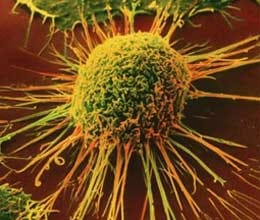 Cancer Diagnosis in only 20 miniutes