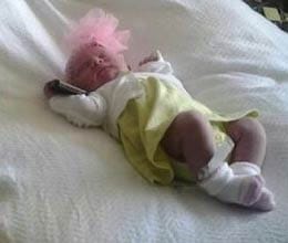 miracle girl born with 25 fingers 