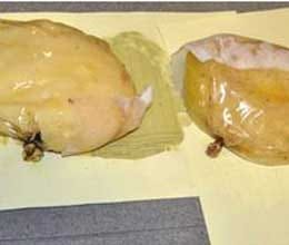 smuggling of cocaine concealing in breast implant 