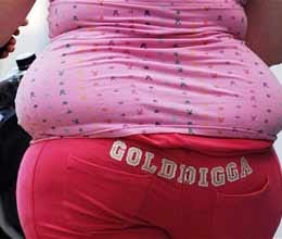 bacteria find key to treating obesity without surgery