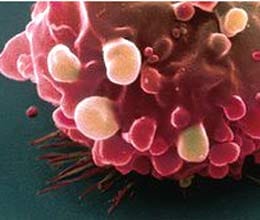 cancer: two village, fifteen days, four killed