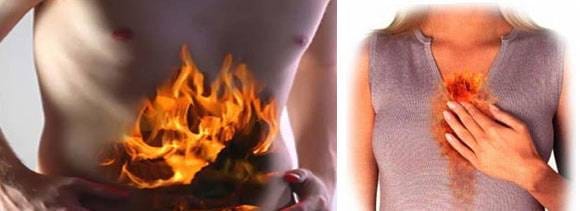 homemade remedies to beat acidity