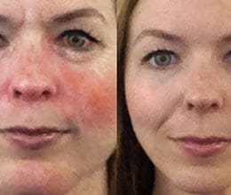 app which will show effect of alcohol on face