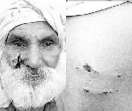 dog bites men in maha kumbh