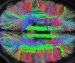 how inside the brain