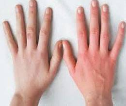 nails reveals health problem 