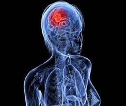 people afflict brain attack